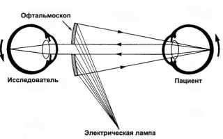Причины появления и способы устранения тумана в глазах