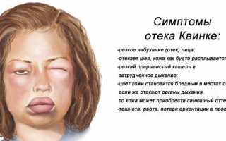 Как не заплакать, когда хочется