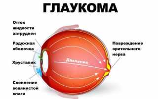 Почему дёргается глаз — причины и лечение