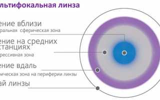 Разновидности контактных линз, плюсы и минусы использования
