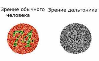 Что такое дальтонизм и как с ним жить