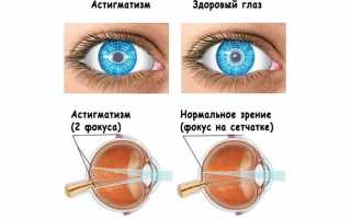 Для чего используются бифокальные очки