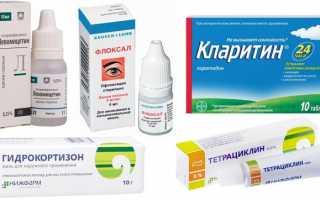 Причины опухания нижнего века глаза и способы лечения