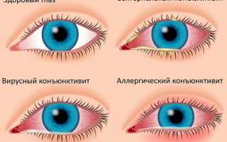 Как правильно промывать глаза детям