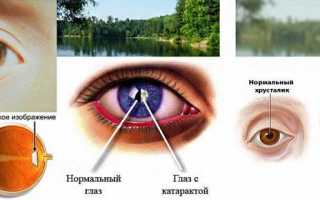 Капли Тауфон для профилактики глазных заболеваний