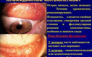 Симптомы и лечение хламидийного конъюнктивита