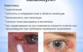 Почему могут слезиться глазки у грудничка
